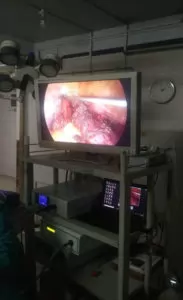 LAPAROSCOPIC GYNECOLOGICAL SURGERY DURING THE COVID PANDEMIC